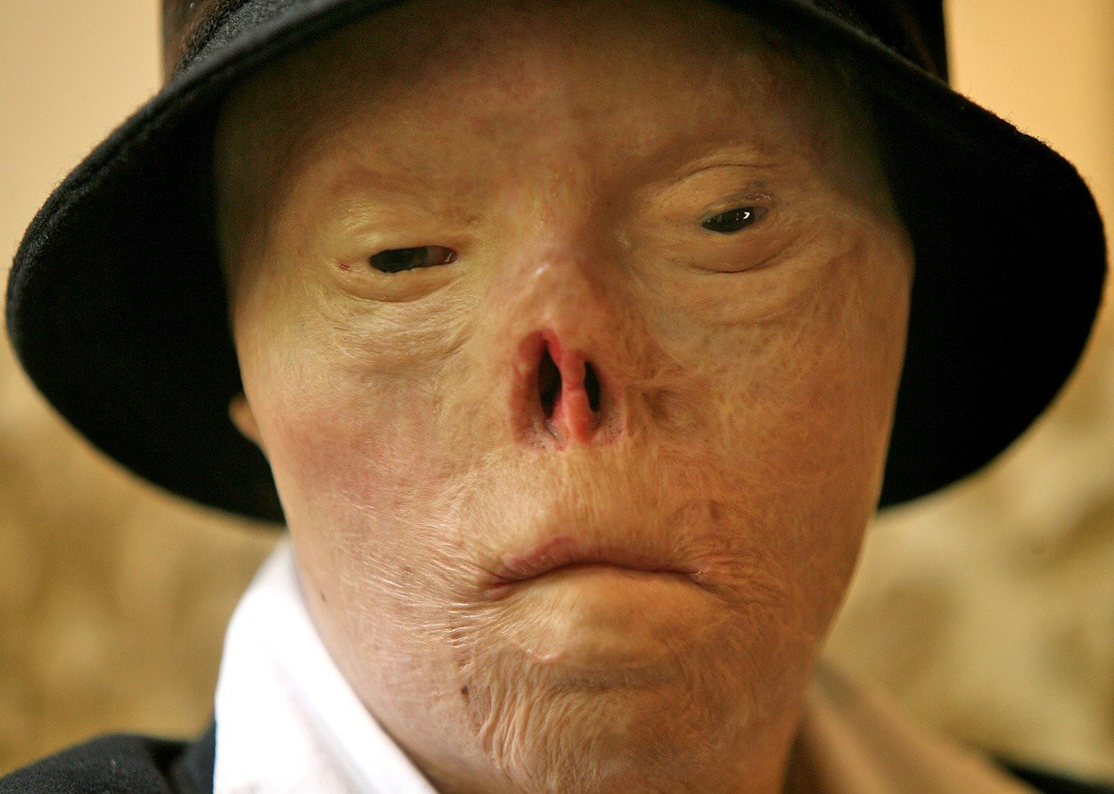 Tanara desfigurata - 2