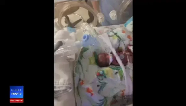Cel mai mic bebeluş din lume, născut la 245 de grame, a fost externat