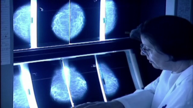 Tratamentul revoluționar care ajută femeile diagnosticate cu cancer mamar. Cât costă