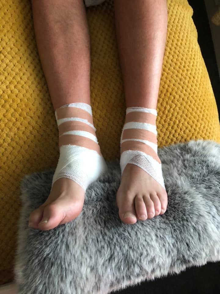 Pasagerul unui avion, ars de un membru al echipajului. „A vărsat apă fiartă pe gleznele lui”