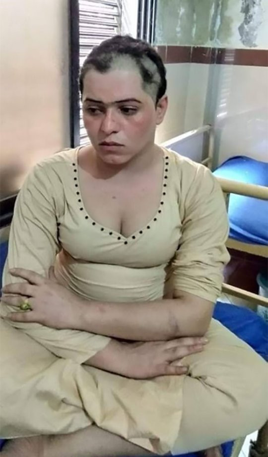 Tânăra bătută, agresată şi rasă în cap din cauza orientării sexuale. Cum a fost găsită. FOTO