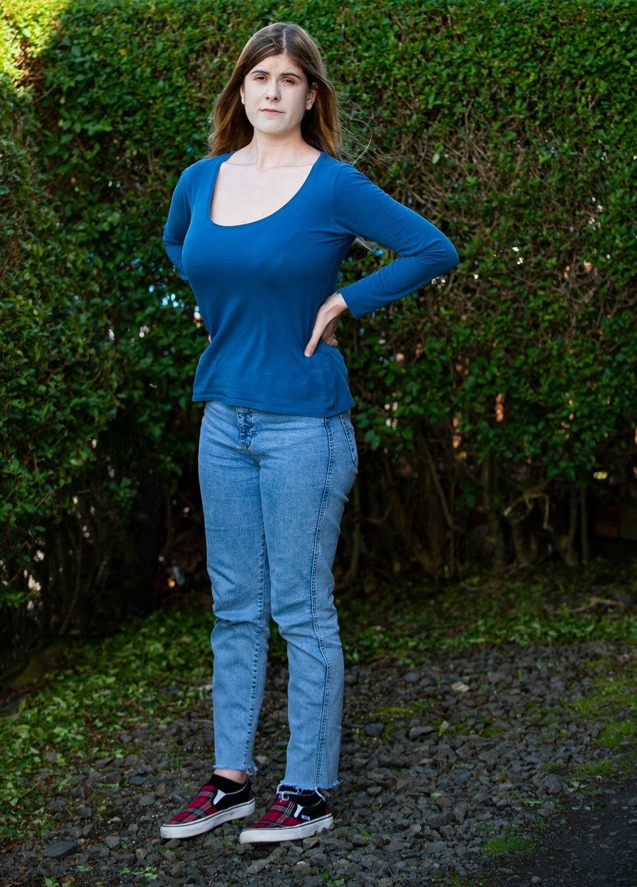 Cum arată femeia care le cere oamenilor bani pentru operația de micșorare a sânilor