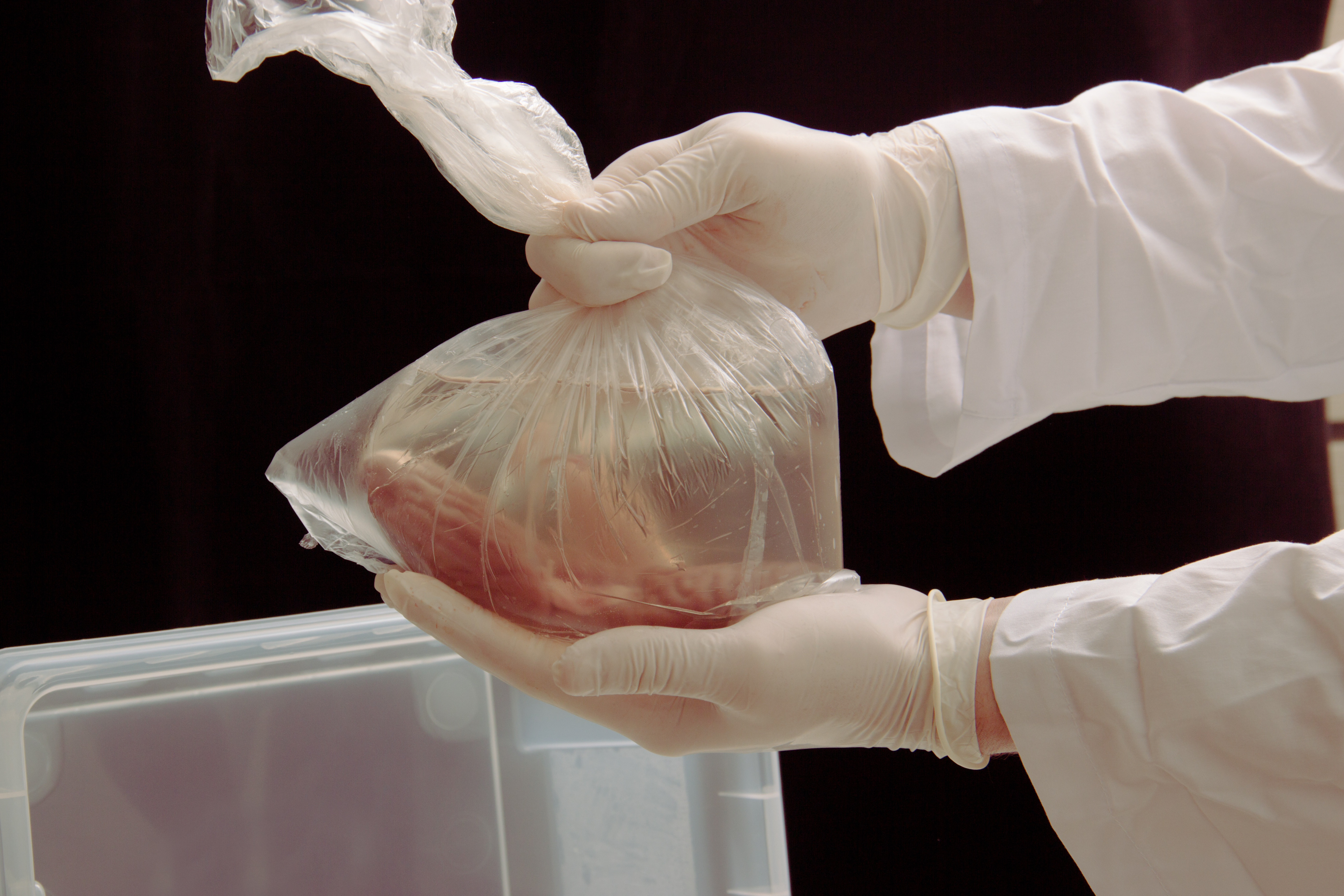 Țara acuzată că fură organele deținuților executați