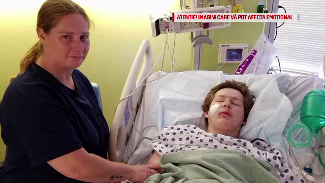 La un pas de moarte, după ce lama unui cuțit i s-a înfipt în față. Greșeala făcută de tânăr