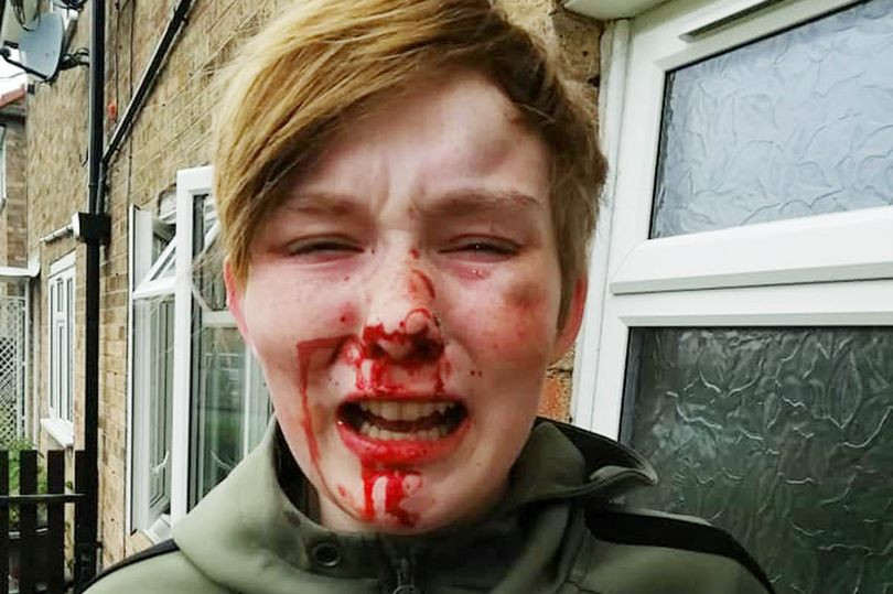 Tânără de 18 ani snopita în bătaie în plină strada pentru că era lesbiană. Cine sunt agresorii