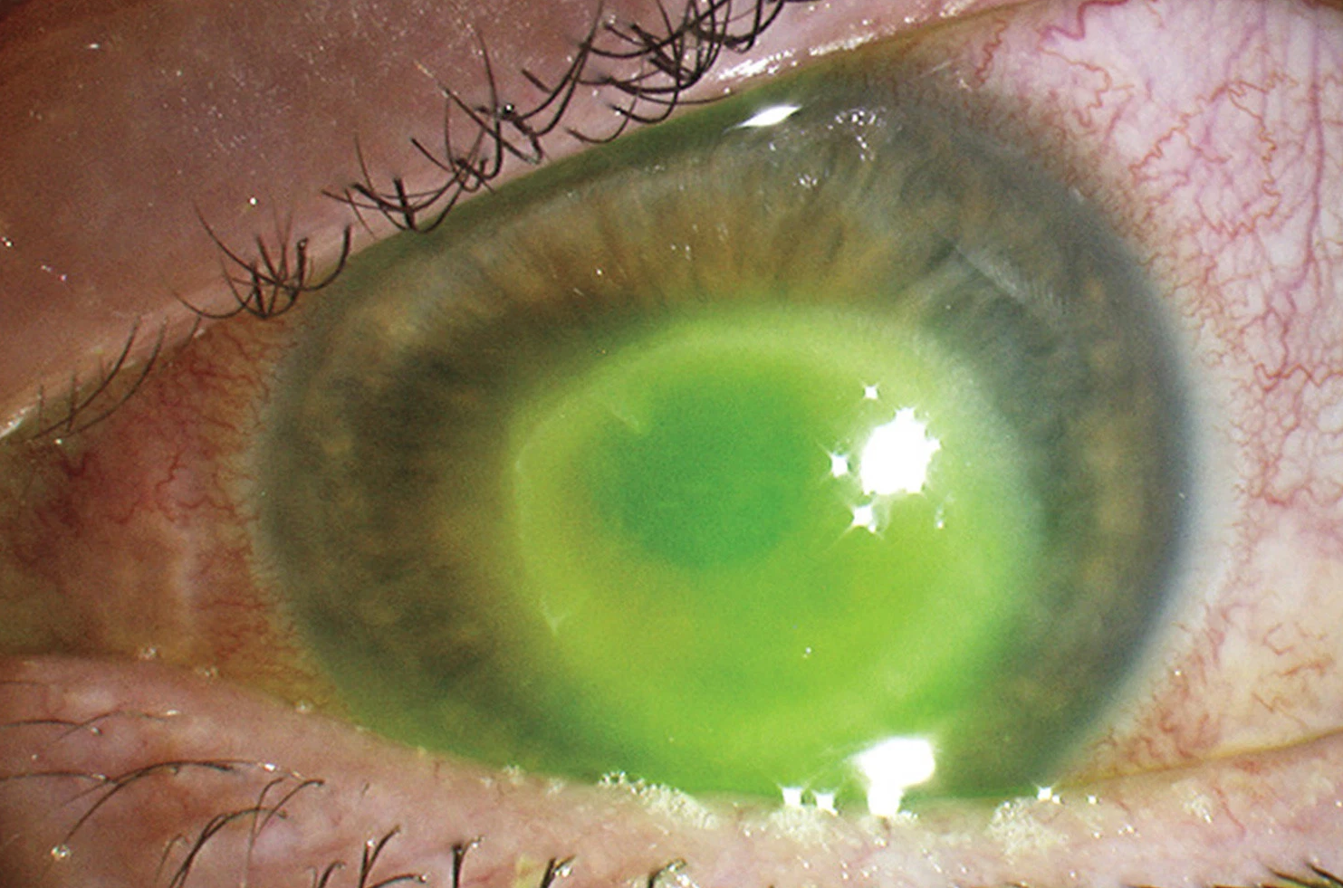 S-a trezit cu un parazit în ochi din cauza unei greşeli făcute la duş. Reacţia medicilor