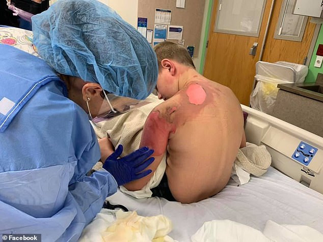 Farsă șocantă în SUA: un tânăr a aruncat apă fierbinte pe prietenul său. VIDEO