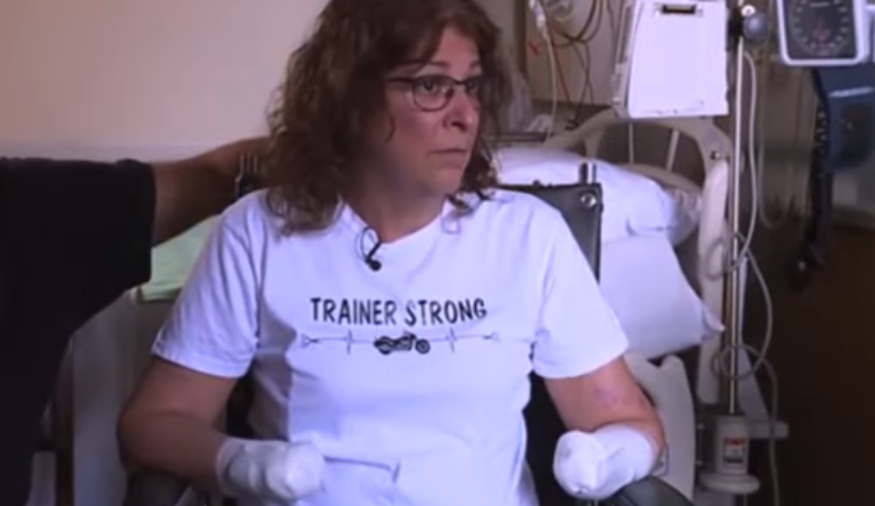 Infecția rară care a lăsat-o pe o femeie fără mâini și picioare. Ce a pățit pacienta