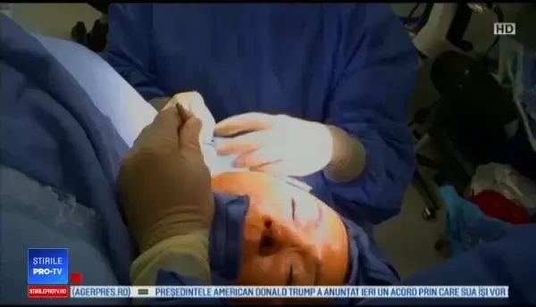 Generația ”Baby boomers”. Cine sunt cei care vor transplant de păr sau injecţii cu botox