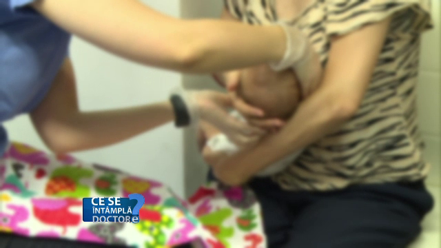 Ce este frenul lingual și cum poate afecta alăptarea noilor născuți