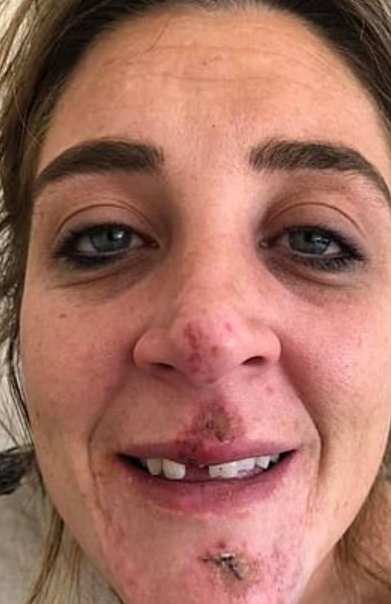 2 soți, bătuți &icirc;n stradă. Agresorul a fost condamnat cu suspendare