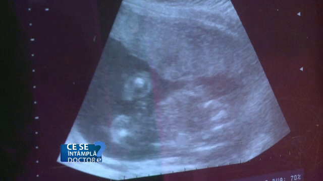 Tratamentele stomatologice sunt posibile în timpul sarcinii