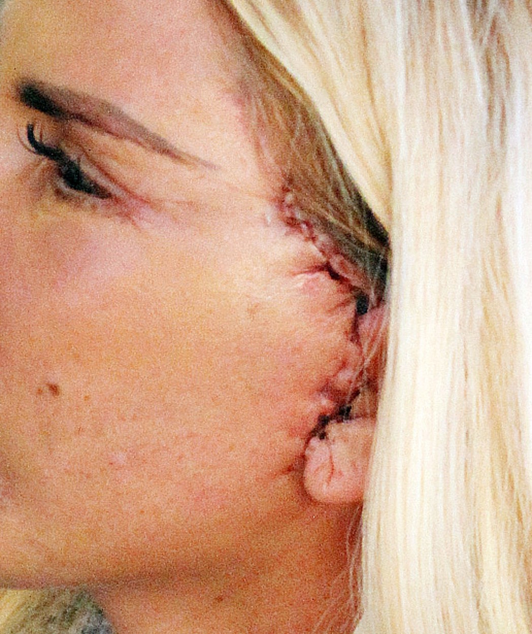 Vedeta a mers la plajă la scurt timp după operaţiile estetice. Imaginile i-au îngrozit pe fani