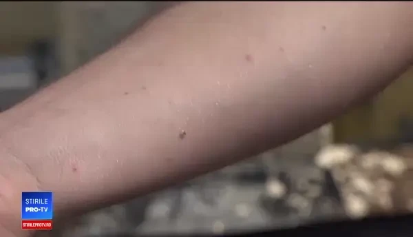 Tigrul platanului face ravagii în parcurile din țară: Nu reacţionează la niciun spray