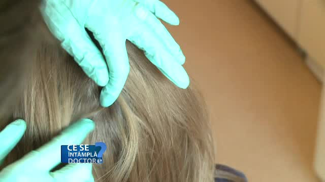 Stresul zilnic are impact direct asupra scalpului, crescând producția de sebum