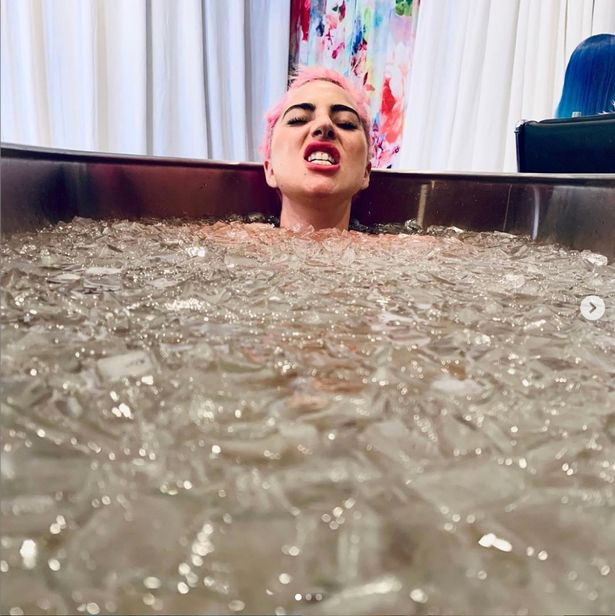 Lady Gaga, apariție nud după incidentul din timpul concertului. Explicația artistei