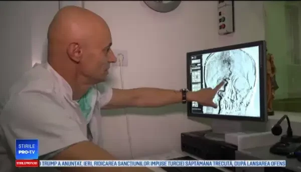 Mărturia unei tinere românce care a suferit un atac cerebral. "M-am trezit paralizată"