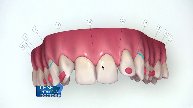 Cum afectează fumatul cavitatea bucală. Riscurile la care sunteți supuși