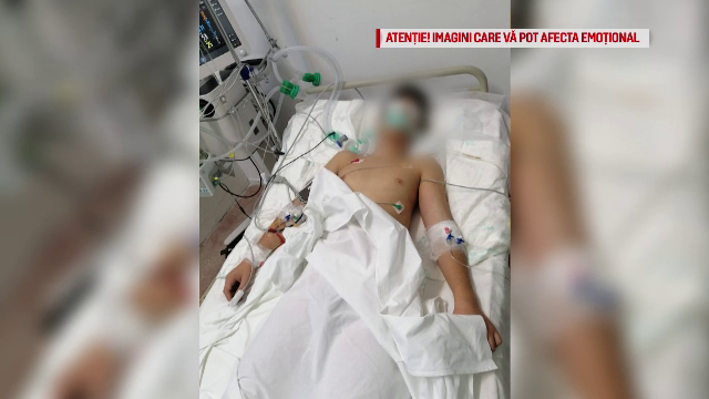 Apelul disperat al părinților băiatului aflat în comă după ce a fost lovit de un adolescent