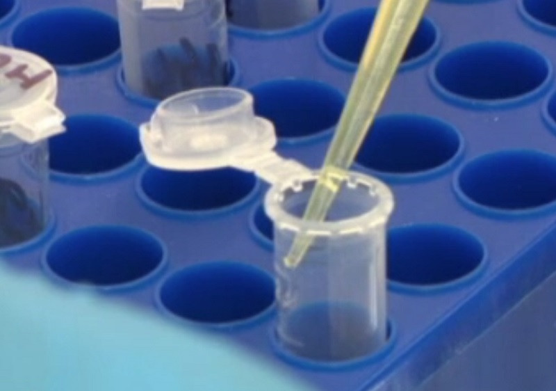 Care sunt cauzele anemiilor și cum pot fi tratate. Sfaturile specialiștilor