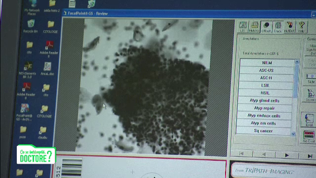 România, în topul ţărilor cu cazuri de cancer de col uterin