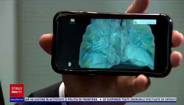 Un medic american explică cum ne afectează organismul Covid-19. „O vătămare extinsă a plămânului”