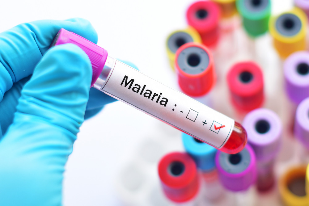 Malaria a atins o proporţie epidemică în Etiopia. S-au raportat peste 300.000 de cazuri săptămânal