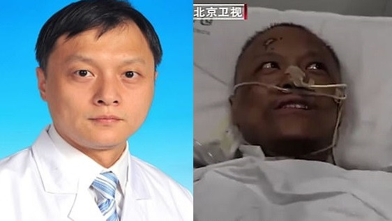 Doi medici care au dezvoltat o formă gravă de Covid-19 sunt acum de nerecunoscut. Ce s-a întâmplat