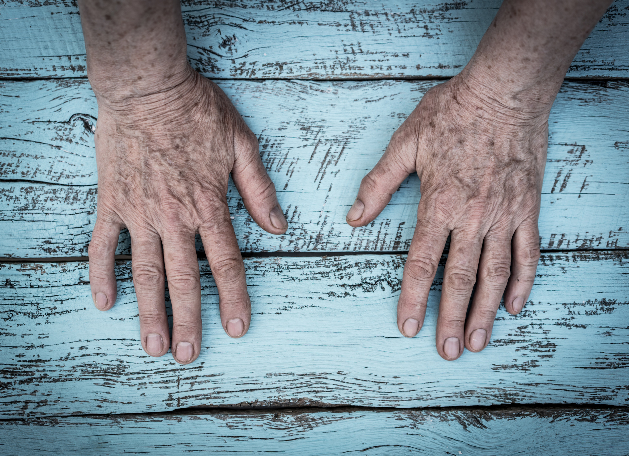 A murit cel mai bătrân bărbat din lume. Ce vârstă avea