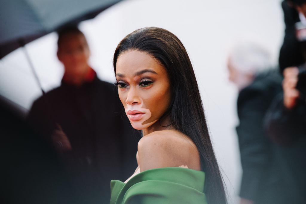 Modelul Winnie Harlow, apariție spectaculoasă pe străzile din Miami alături de cățelul ei | GALERIE FOTO