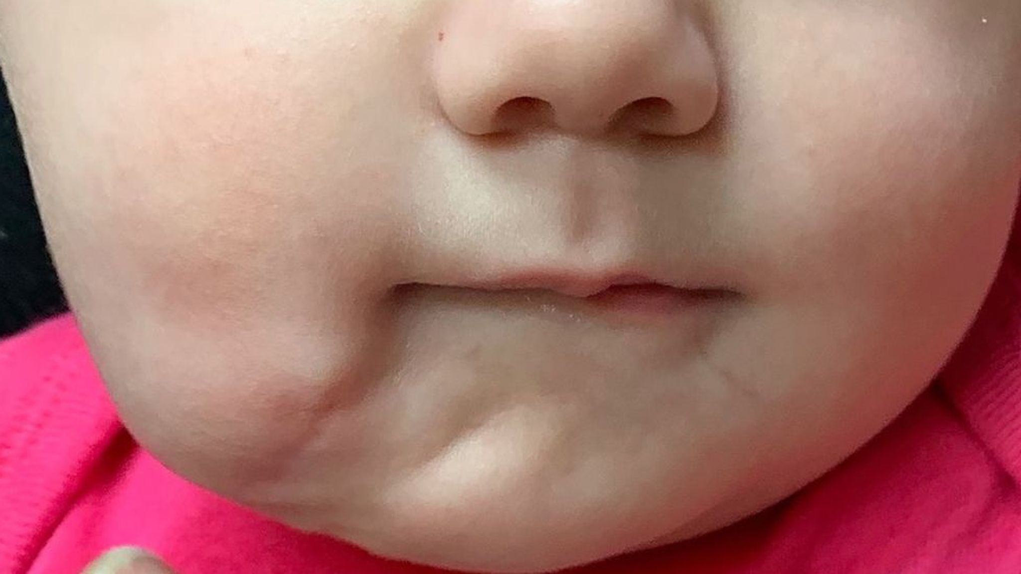 bebeluș cu două guri sua