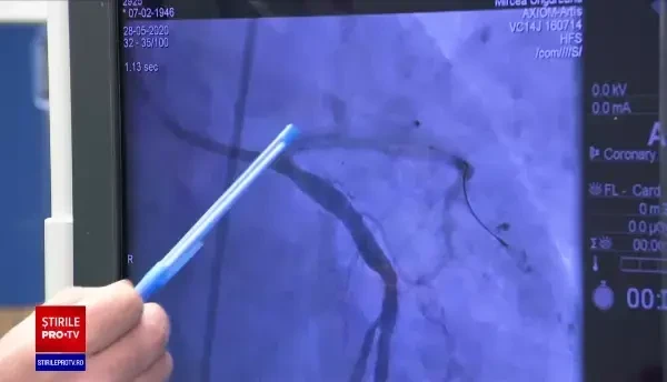 Tehnica revoluționară care te salvează de infarct. Cum funcționează