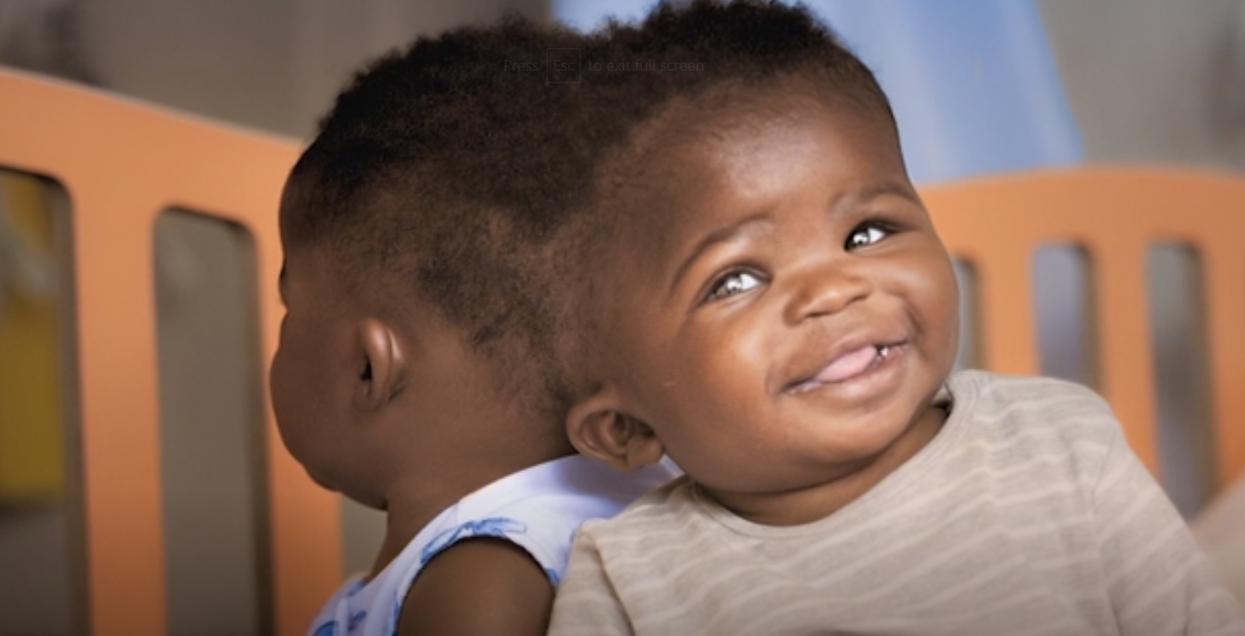 Siameze unite în zona capului, separate cu succes în Italia. Cum arată acum. VIDEO