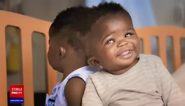 Siameze unite în zona capului, separate cu succes în Italia. Cum arată acum. VIDEO