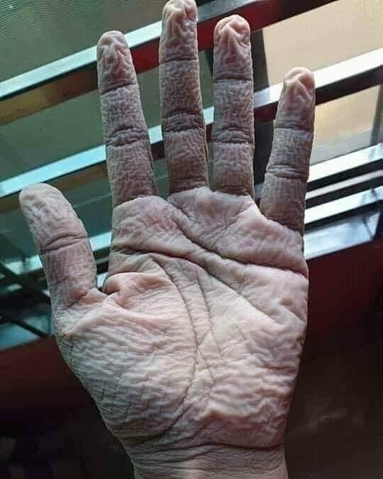 maini, medici, Covid-19