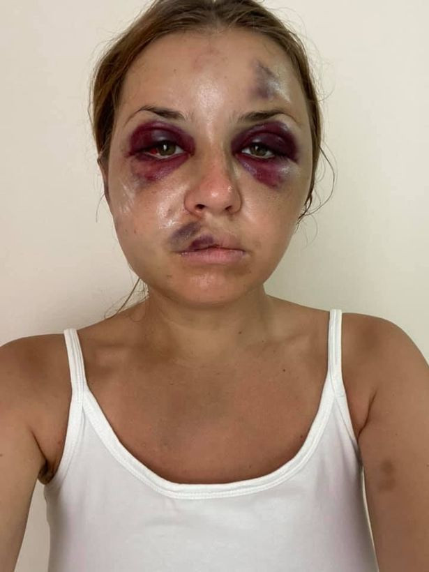 Vedetă TV, bătută de un bărbat care a &icirc;ncercat să o violeze &icirc;n fața copilului ei. &rdquo;Mami, iartă-mă că nu am putut să te apăr&rdquo;