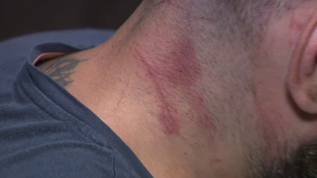 Doi bărbați din Capitală ar fi fost duși pe câmp și bătuți de polițiști. Ce spun agenții