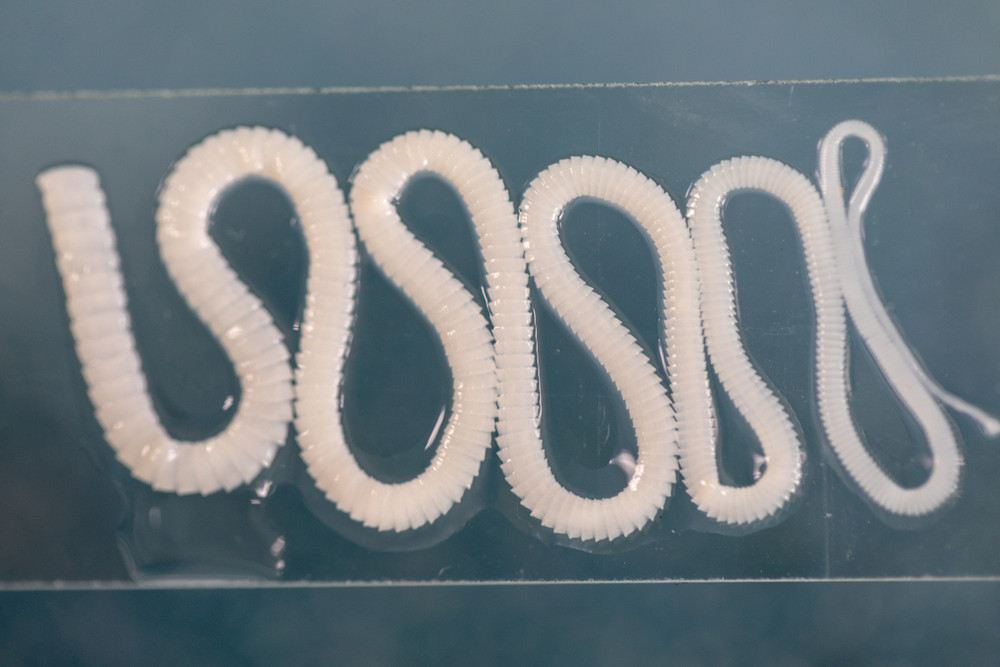 Un șofer de taxi avea în burtă o tenie de 5 metri. A scos-o afară într-un mod oribil