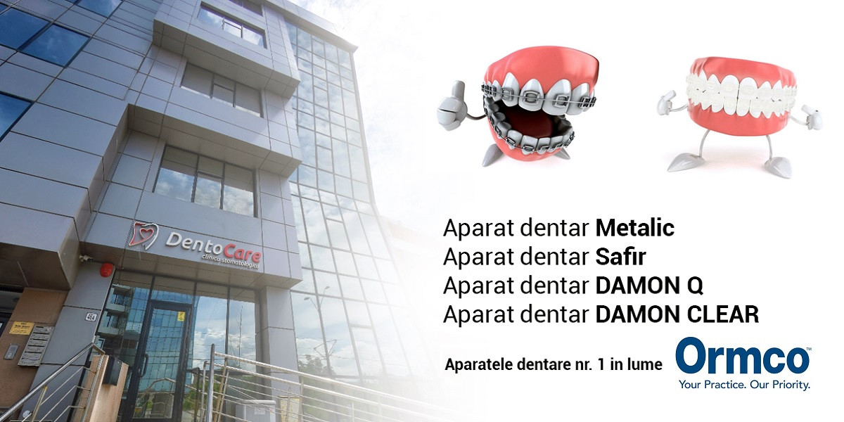 (P) Află ce tip de aparat dentar ți se potrivește