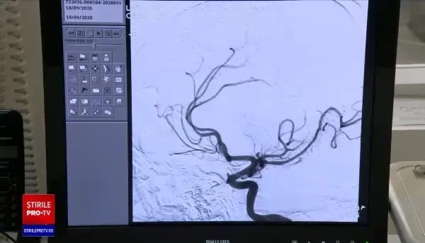 Situație dramatică în România: 4 oameni mor în fiecare oră din cauza unui AVC. Soluția propusă de autorități