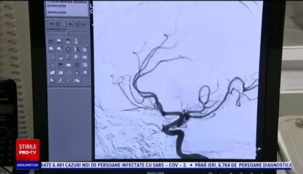 Situație dramatică în România: 4 oameni mor în fiecare oră din cauza unui AVC. Soluția propusă de autorități