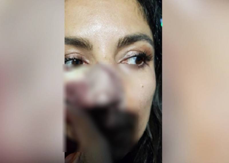 Designerul Cristina Joia, desfigurată de o femeie care a lovit-o cu un obiect dur, a fost audiată