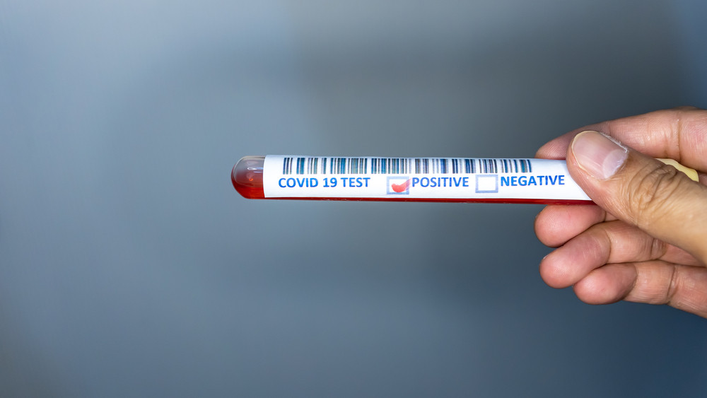 Un bărbat din Alba, testat pozitiv pentru SARS-CoV-2, a plecat în Anglia fără să răspundă apelurilor DSP