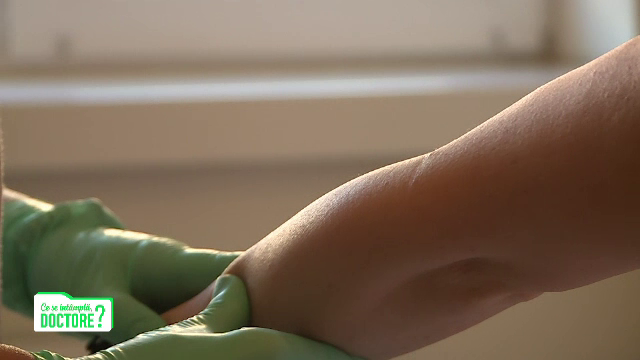 Controlul dermatologic, soluția pentru a preveni bolile grave ale pielii