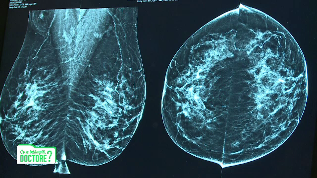 De ce sunt importante vizitele la ginecolog chiar și după instalarea pre-menopauzei. Explicația medicilor