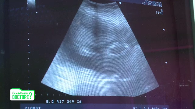 Statistic, cei mai mulți copii sunt concepuți în decembrie. Ce trebuie să știi despre ovulație