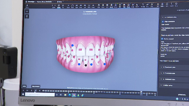 Consumați alimente tari. Vă protejează atât aparatul digestiv, cât și dinții