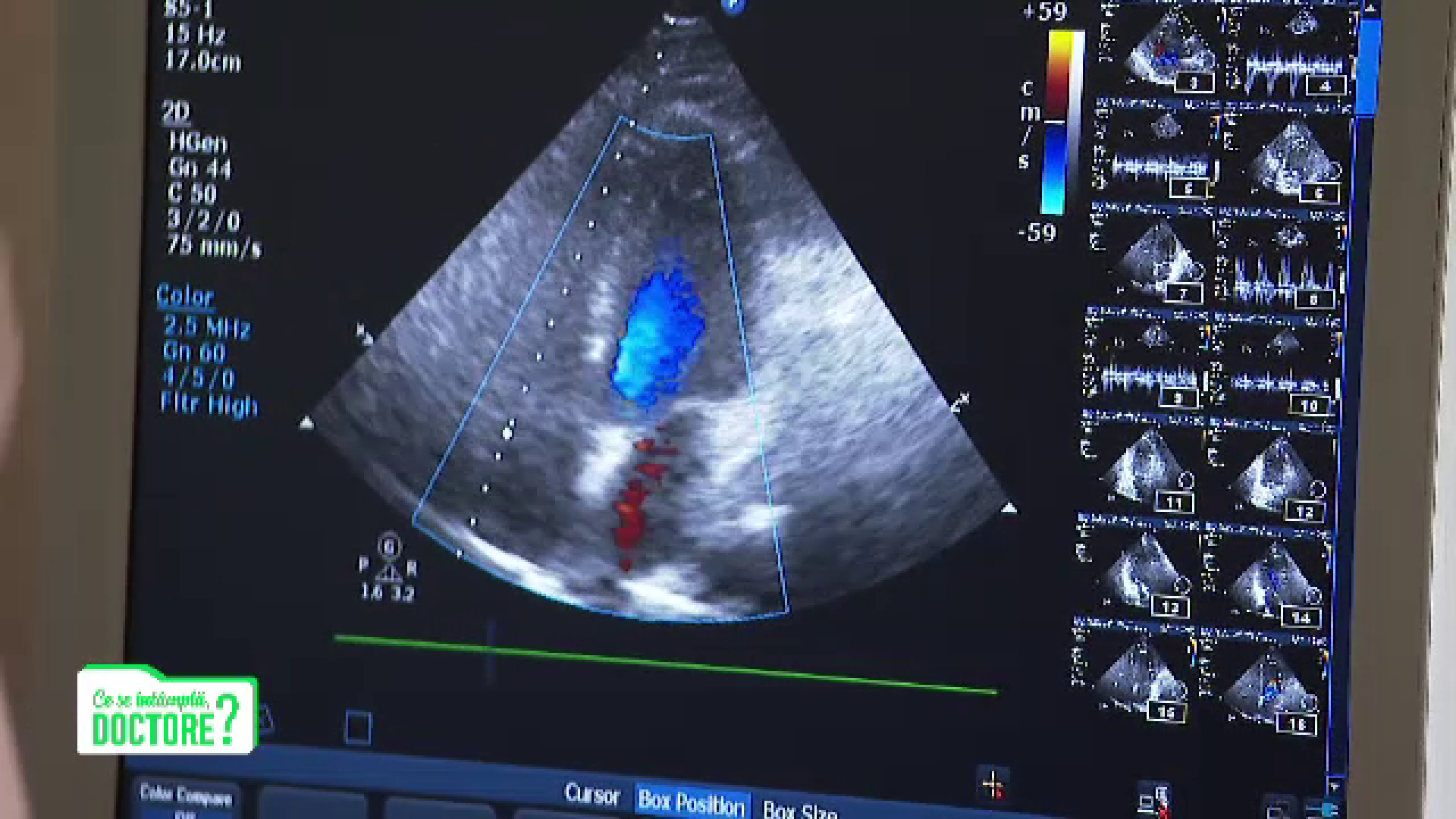 Consultația la medicul cardiolog, recomandarea medicilor după boala Covid-19. Ce presupune controlul