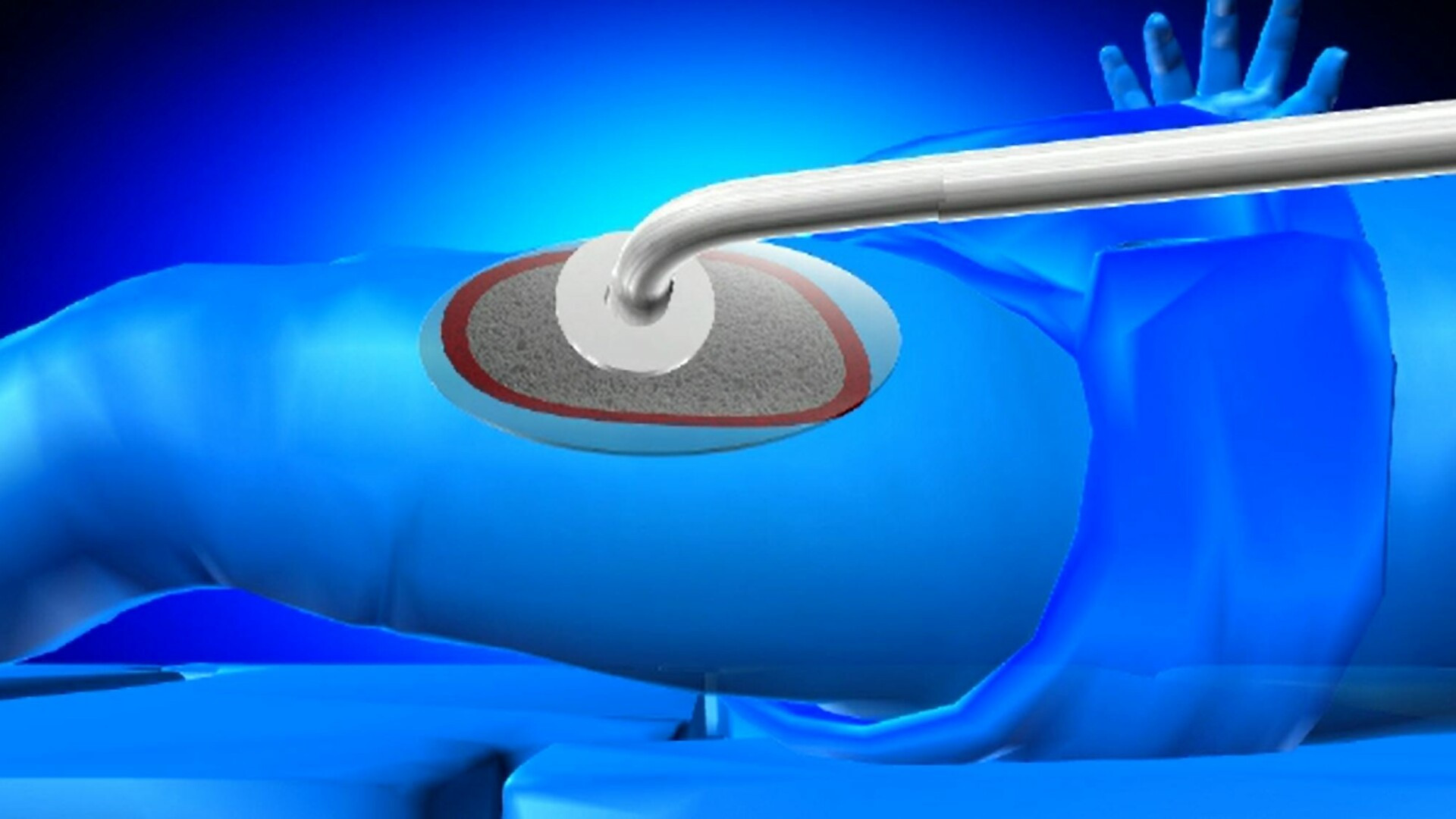 Caz dramatic în Huși. Ce se întâmplă cu o fetiță de doi ani, după ce a fost opărită cu ciorbă