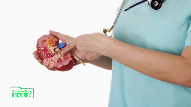 Pietrele la rinichi netratate produc infecții severe. Cum ne putem trata
